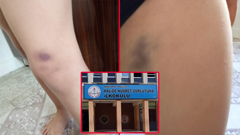 Urfa’da ilkokulda oğlu darp edilen anne şikayetçi oldu;